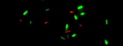 /upload/live-ecoli-dmaoethdiii-composite--bmuhan.jpg